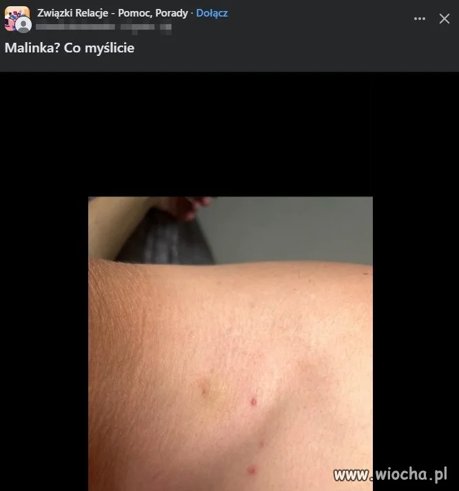 Co myślicie