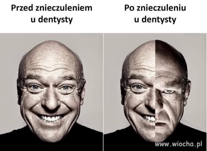 Połowa mojej twarzy nie należy do mnie