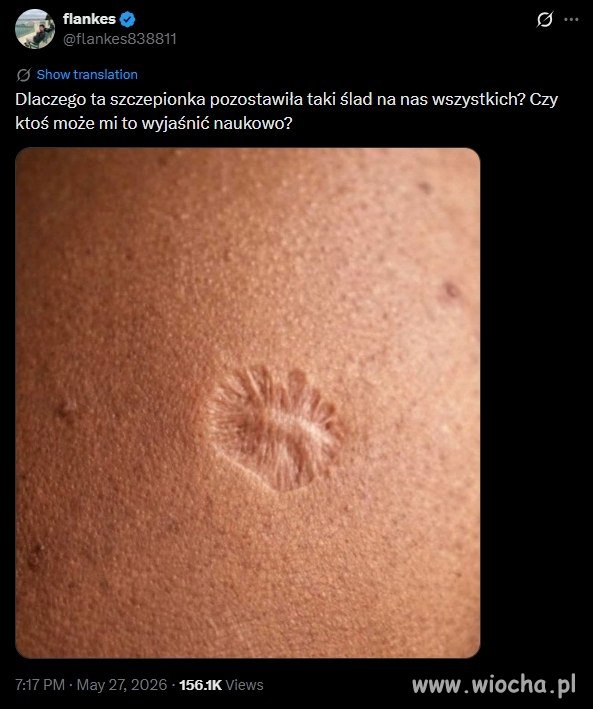 Spokojnie, to mają tylko wybrani