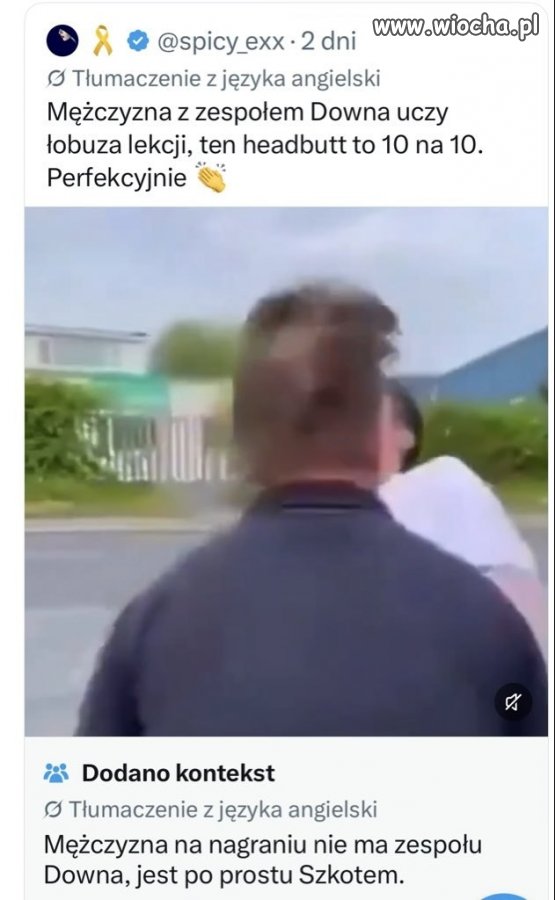 Mężczyzna nie ma Zespołu Downa