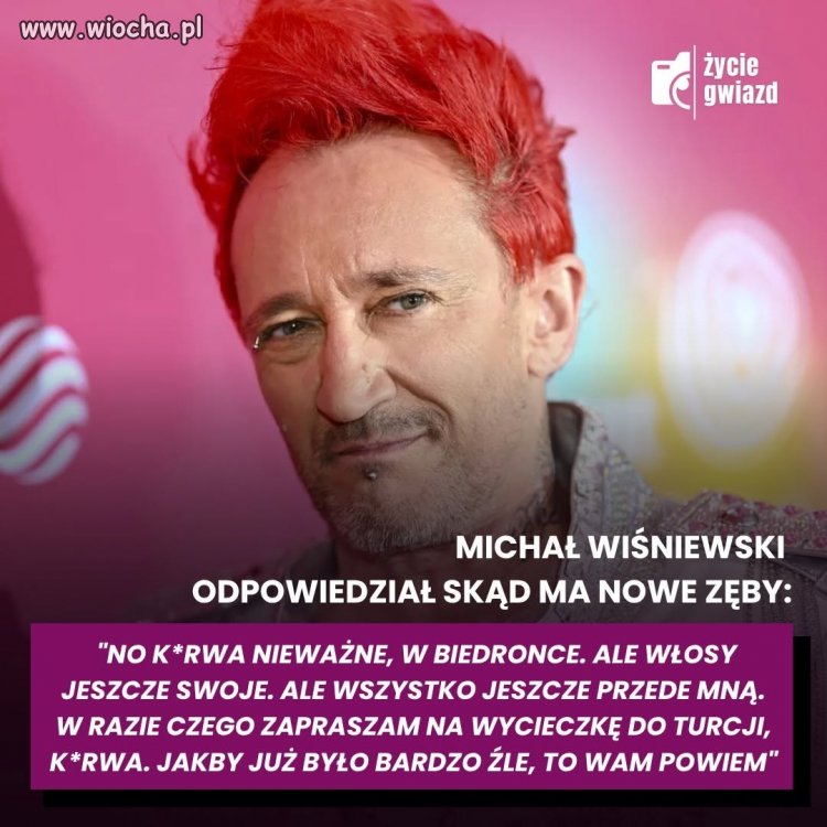 Michał Wiśniewski kupił zęby w Biedronce